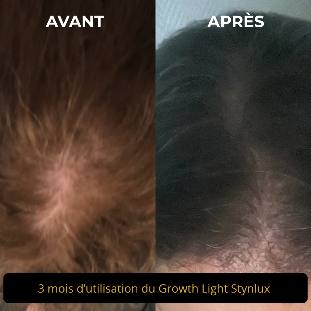 Peigne Masseur Cuir Chevelu STYNLUX Growth-Light