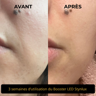 Booster LED visage 4 en 1 STYNLUX