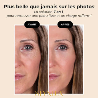 Avant après gua sha électrique STYNLUX — résultats peau sculptée